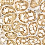 ATF6 Antibody in Immunohistochemistry (Paraffin) (IHC (P))