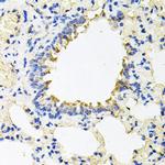 Calumenin Antibody in Immunohistochemistry (Paraffin) (IHC (P))