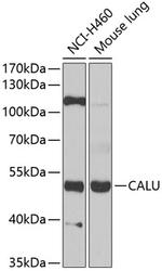 Calumenin Antibody in Western Blot (WB)