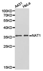 NAT1 Antibody in Western Blot (WB)