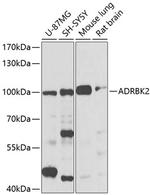 GRK3 Antibody in Western Blot (WB)