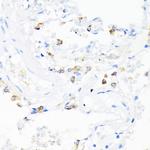 Cathelicidin Antibody in Immunohistochemistry (Paraffin) (IHC (P))