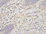 PSMA6 Antibody in Immunohistochemistry (Paraffin) (IHC (P))