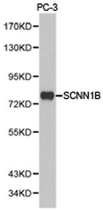 SCNN1B Antibody in Western Blot (WB)