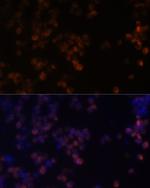 Zyxin Antibody in Immunocytochemistry (ICC/IF)