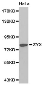 Zyxin Antibody in Western Blot (WB)