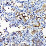 NOX4 Antibody in Immunohistochemistry (Paraffin) (IHC (P))