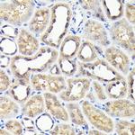 NOX4 Antibody in Immunohistochemistry (Paraffin) (IHC (P))