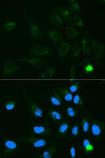 UGT1A9 Antibody in Immunocytochemistry (ICC/IF)