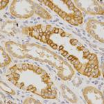 IL23R Antibody in Immunohistochemistry (Paraffin) (IHC (P))