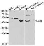 IL23R Antibody in Western Blot (WB)