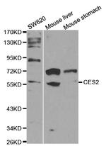 CES2 Antibody in Western Blot (WB)