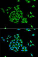 PICK1 Antibody in Immunocytochemistry (ICC/IF)