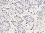 PICK1 Antibody in Immunohistochemistry (Paraffin) (IHC (P))