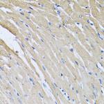 CRHBP Antibody in Immunohistochemistry (Paraffin) (IHC (P))