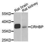 CRHBP Antibody in Western Blot (WB)