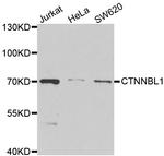 CTNNBL1 Antibody in Western Blot (WB)