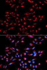 C1QBP Antibody in Immunocytochemistry (ICC/IF)