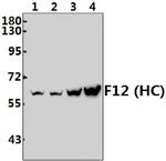 Factor XII Heavy chain Antibody in Western Blot (WB)