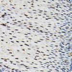 SFPQ Antibody in Immunohistochemistry (Paraffin) (IHC (P))