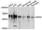 KRT9 Antibody in Western Blot (WB)