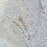 TEC Antibody in Immunohistochemistry (Paraffin) (IHC (P))