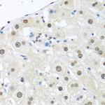 Ubiquitin C Antibody in Immunohistochemistry (Paraffin) (IHC (P))