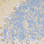 COX6A1 Antibody in Immunohistochemistry (Paraffin) (IHC (P))