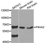 P4HA2 Antibody in Western Blot (WB)