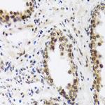 SAFB2 Antibody in Immunohistochemistry (Paraffin) (IHC (P))