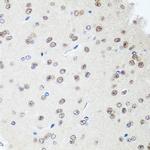 SAP18 Antibody in Immunohistochemistry (Paraffin) (IHC (P))