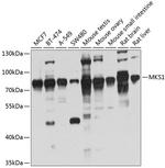 MKS1 Antibody in Western Blot (WB)