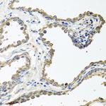 COLEC11 Antibody in Immunohistochemistry (Paraffin) (IHC (P))