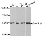 DHCR24 Antibody in Western Blot (WB)