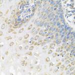 PABPC4 Antibody in Immunohistochemistry (Paraffin) (IHC (P))