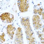 C8orf4 Antibody in Immunohistochemistry (Paraffin) (IHC (P))