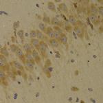 SCO2 Antibody in Immunohistochemistry (Paraffin) (IHC (P))