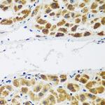 NAT15 Antibody in Immunohistochemistry (Paraffin) (IHC (P))