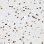 AEBP2 Antibody in Immunohistochemistry (Paraffin) (IHC (P))