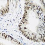 AEBP2 Antibody in Immunohistochemistry (Paraffin) (IHC (P))