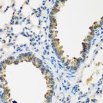 CYP2F1 Antibody in Immunohistochemistry (Paraffin) (IHC (P))