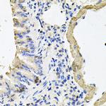 MYH7 Antibody in Immunohistochemistry (Paraffin) (IHC (P))