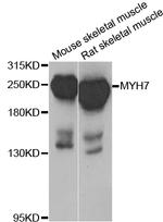 MYH7 Antibody in Western Blot (WB)