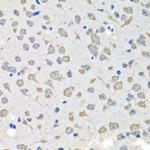 C1GALT1C1 Antibody in Immunohistochemistry (Paraffin) (IHC (P))