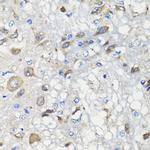 BCS1L Antibody in Immunohistochemistry (Paraffin) (IHC (P))