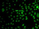 TRPS1 Antibody in Immunocytochemistry (ICC/IF)