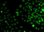 TRPS1 Antibody in Immunocytochemistry (ICC/IF)