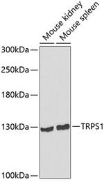 TRPS1 Antibody in Western Blot (WB)