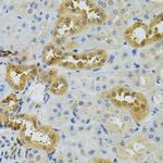 NAT8 Antibody in Immunohistochemistry (Paraffin) (IHC (P))