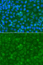 ACAD9 Antibody in Immunocytochemistry (ICC/IF)